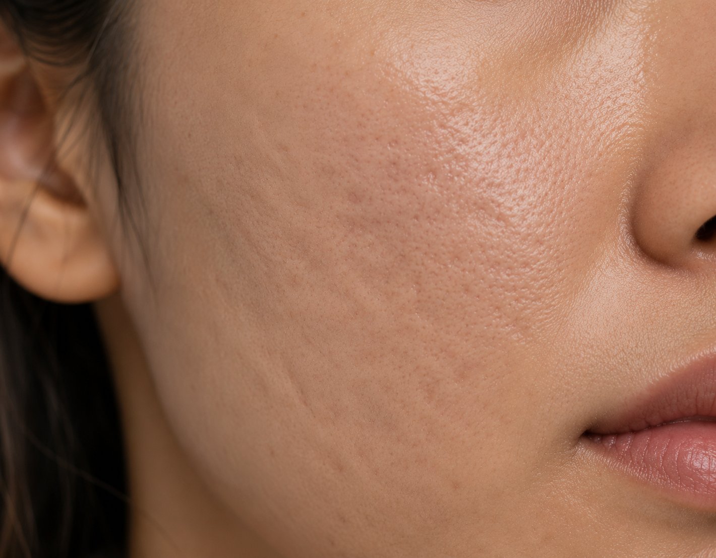 Close-up of uneven skin texture
