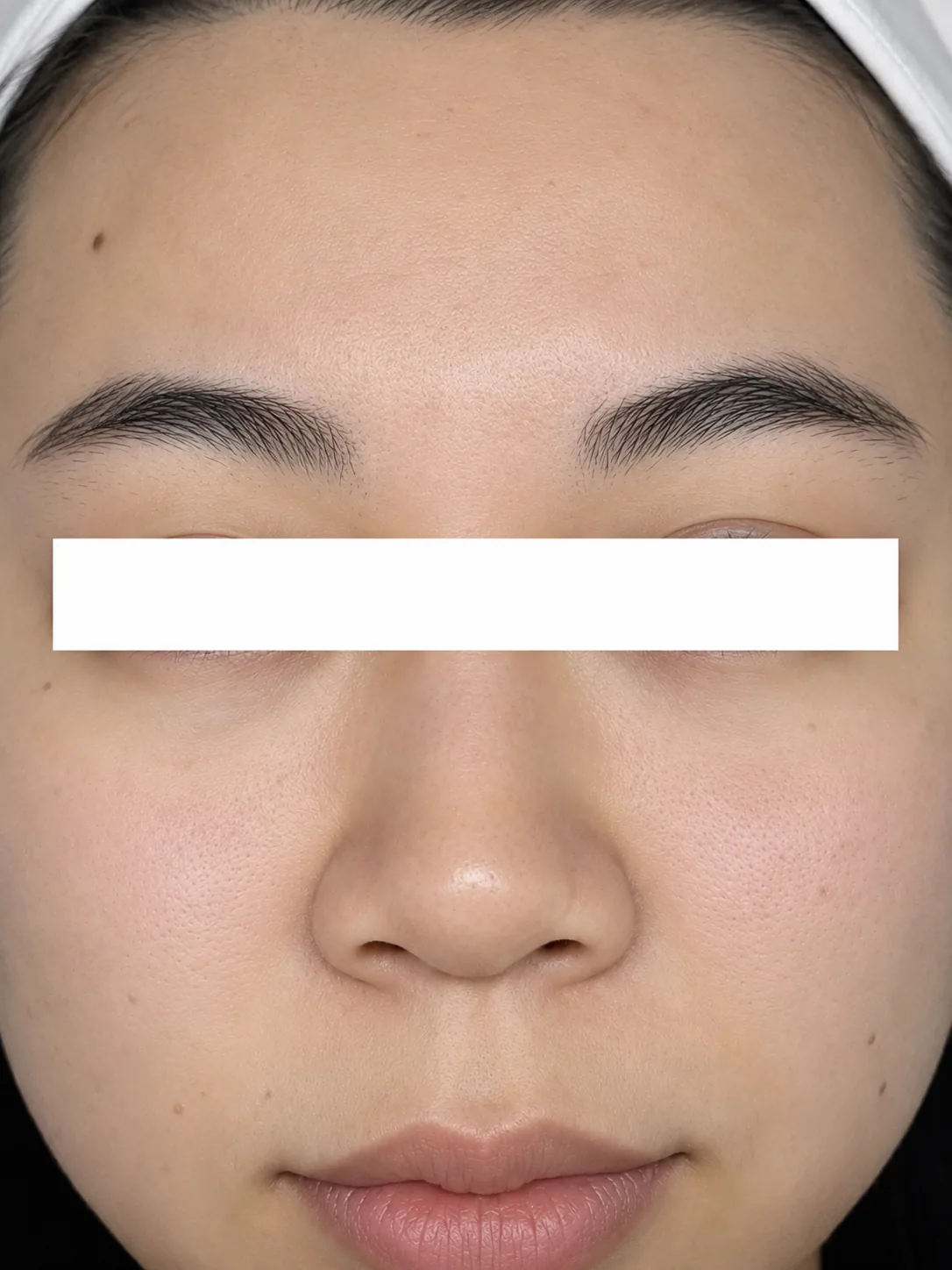 After The Pore Refining Facial result