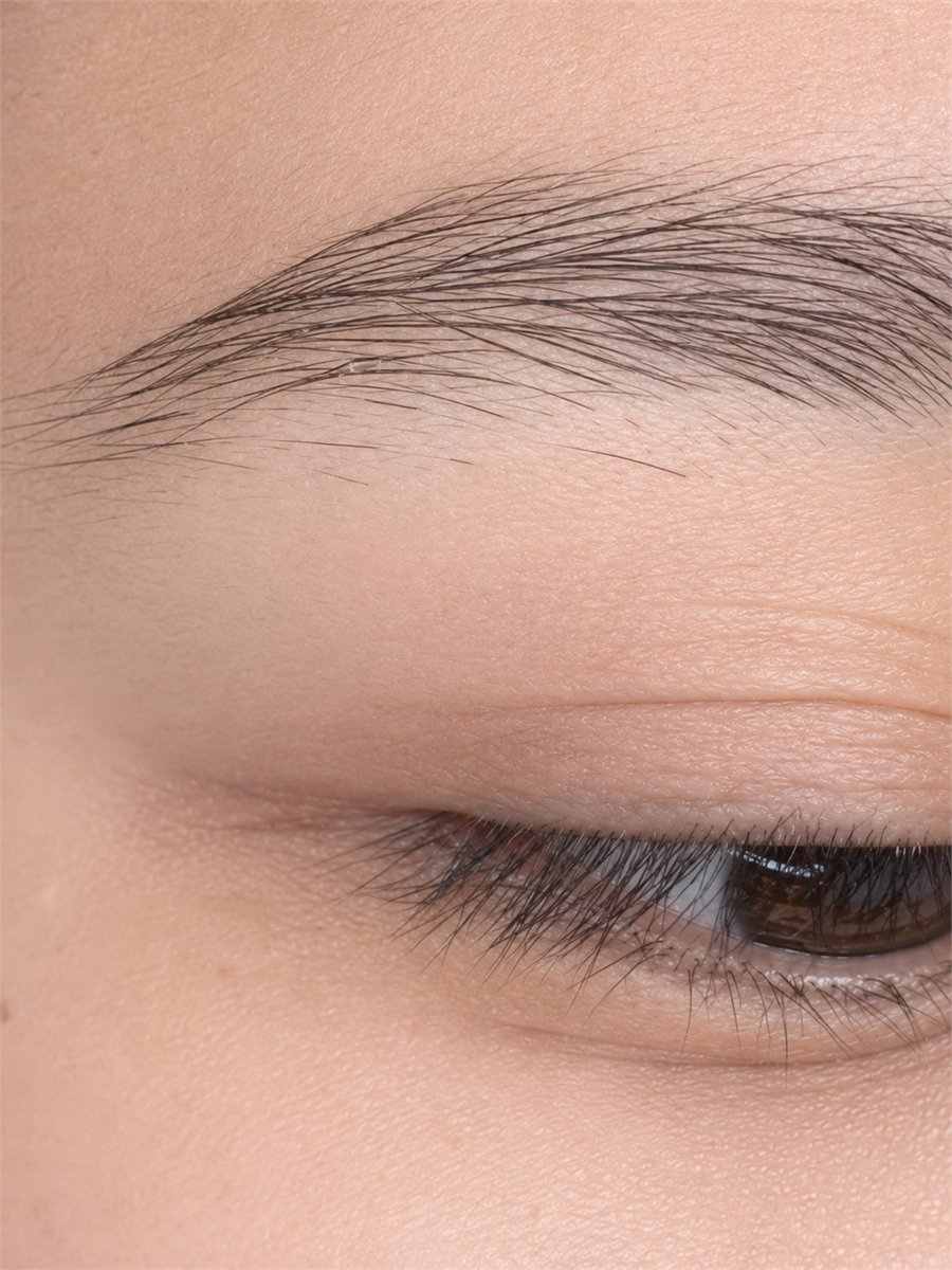 Before brow embroidery treatment