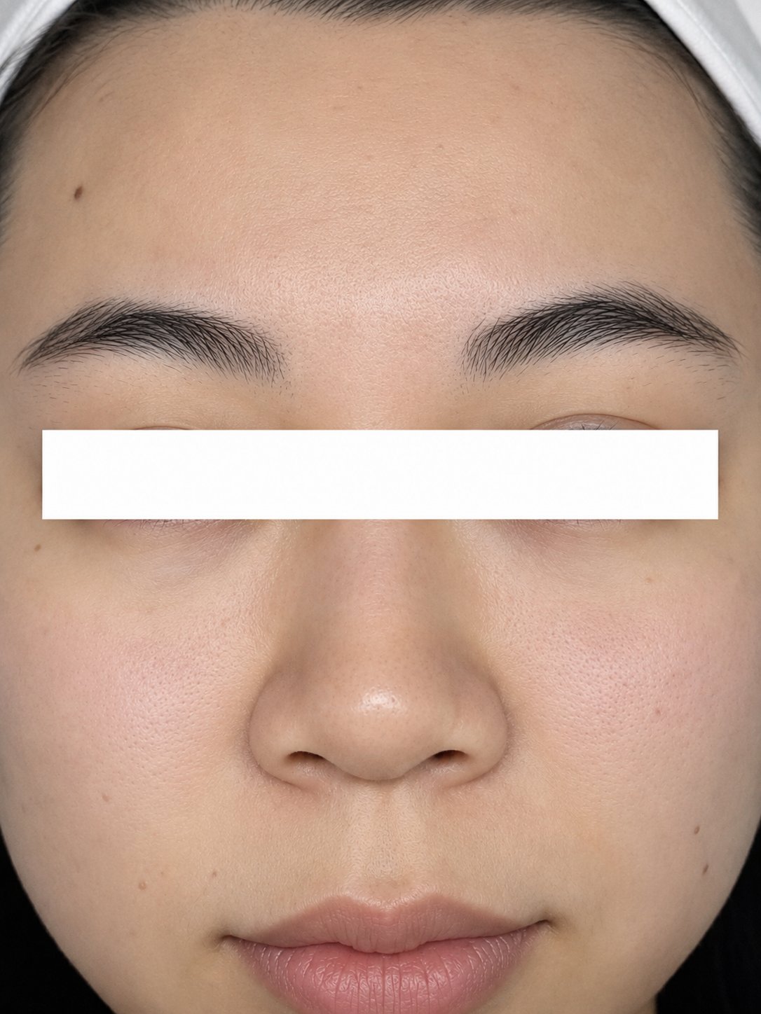 After Pore Refining Facial